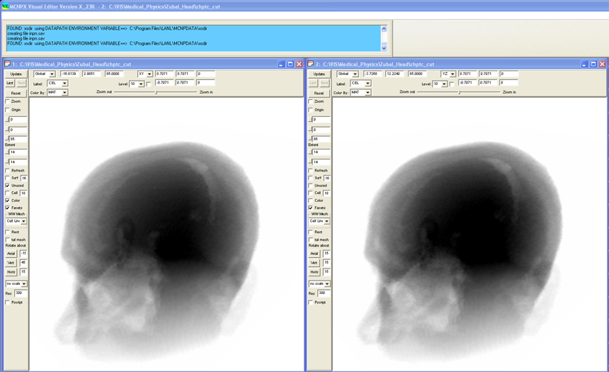 3D Radiographic plot of a Human Brain